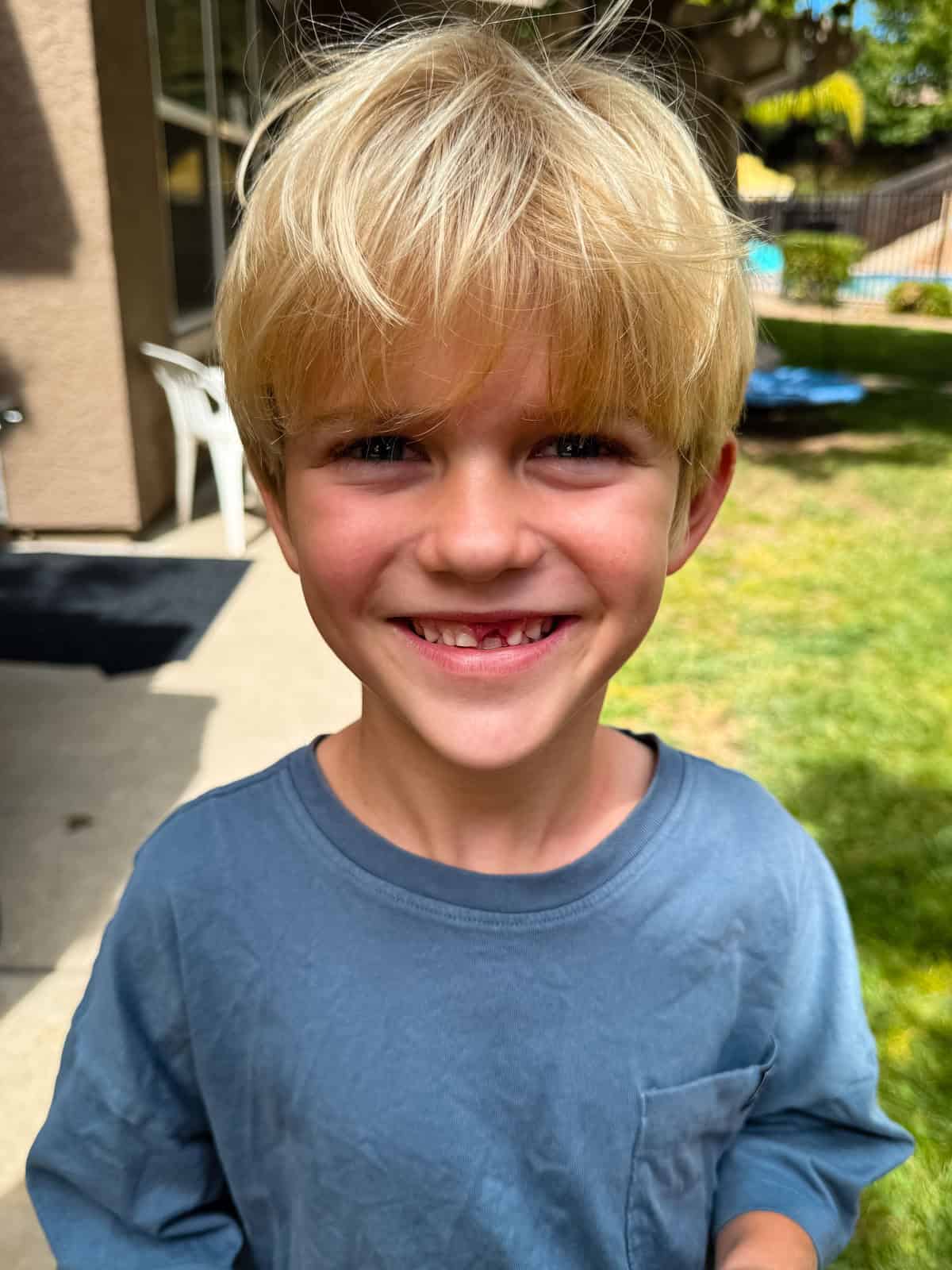 A young boy with blonde hair smiling to show a missing front tooth.